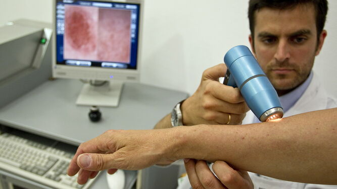 Un dermatólogo realiza una prueba de detección del cáncer de piel.